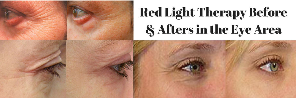 Red Light Therapy Reduce Wrinkles Age Spots Acne And More